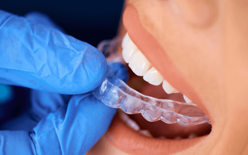 braces